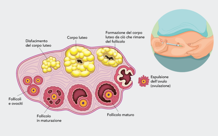 BabyHeART_stimolazione_crescita_follicolare_multipla